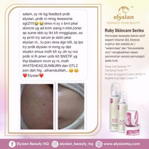 INFO: RUBY CELLACTIVE WHITE , ELYSIAN BOOSTER SERUM AND SET BASIC ELYSIAN, KOSMETIK CIDA