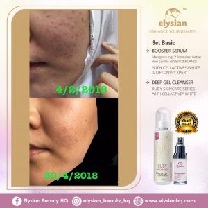 INFO: RUBY CELLACTIVE WHITE , ELYSIAN BOOSTER SERUM AND SET BASIC ELYSIAN, KOSMETIK CIDA