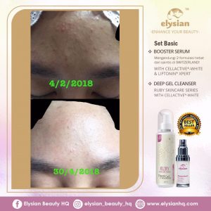 INFO: RUBY CELLACTIVE WHITE , ELYSIAN BOOSTER SERUM AND SET BASIC ELYSIAN, KOSMETIK CIDA