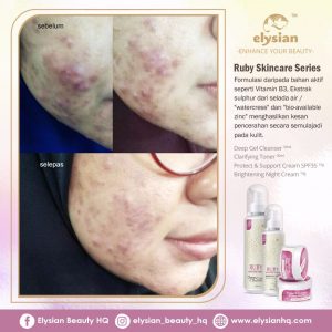 INFO: RUBY CELLACTIVE WHITE , ELYSIAN BOOSTER SERUM AND SET BASIC ELYSIAN, KOSMETIK CIDA