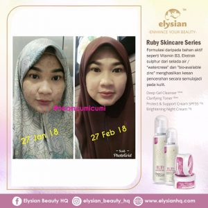 INFO: RUBY CELLACTIVE WHITE , ELYSIAN BOOSTER SERUM AND SET BASIC ELYSIAN, KOSMETIK CIDA