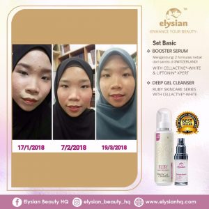 INFO: RUBY CELLACTIVE WHITE , ELYSIAN BOOSTER SERUM AND SET BASIC ELYSIAN, KOSMETIK CIDA