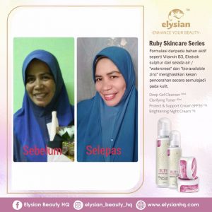 INFO: RUBY CELLACTIVE WHITE , ELYSIAN BOOSTER SERUM AND SET BASIC ELYSIAN, KOSMETIK CIDA