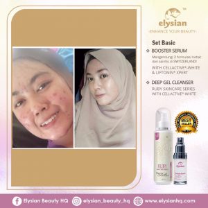 INFO: RUBY CELLACTIVE WHITE , ELYSIAN BOOSTER SERUM AND SET BASIC ELYSIAN, KOSMETIK CIDA