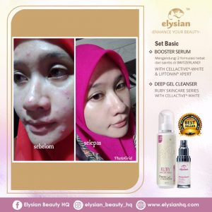 INFO: RUBY CELLACTIVE WHITE , ELYSIAN BOOSTER SERUM AND SET BASIC ELYSIAN, KOSMETIK CIDA