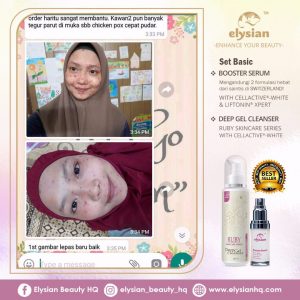 INFO: RUBY CELLACTIVE WHITE , ELYSIAN BOOSTER SERUM AND SET BASIC ELYSIAN, KOSMETIK CIDA