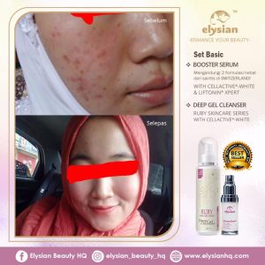 INFO: RUBY CELLACTIVE WHITE , ELYSIAN BOOSTER SERUM AND SET BASIC ELYSIAN, KOSMETIK CIDA