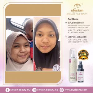 INFO: RUBY CELLACTIVE WHITE , ELYSIAN BOOSTER SERUM AND SET BASIC ELYSIAN, KOSMETIK CIDA