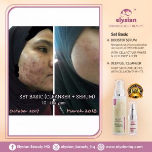 INFO: RUBY CELLACTIVE WHITE , ELYSIAN BOOSTER SERUM AND SET BASIC ELYSIAN, KOSMETIK CIDA