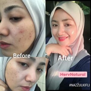 Kebaikan Herv Essence By Herv Natural Road To Glass Skin Kosmetik Cida