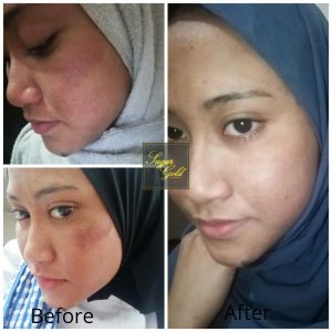 Sugar Gold Oil &#8211; Face oil MALAYSIA- Luxury Beauty OIl, KOSMETIK CIDA