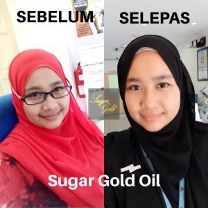 Sugar Gold Oil &#8211; Face oil MALAYSIA- Luxury Beauty OIl, KOSMETIK CIDA