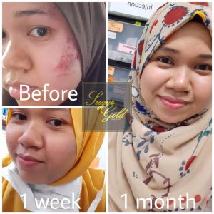 Sugar Gold Oil &#8211; Face oil MALAYSIA- Luxury Beauty OIl, KOSMETIK CIDA