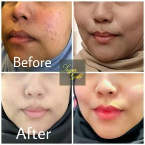 Sugar Gold Oil &#8211; Face oil MALAYSIA- Luxury Beauty OIl, KOSMETIK CIDA