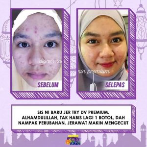 Info Dianz Vitamin Premium, KOSMETIK CIDA