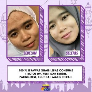 Info Dianz Vitamin Premium, KOSMETIK CIDA