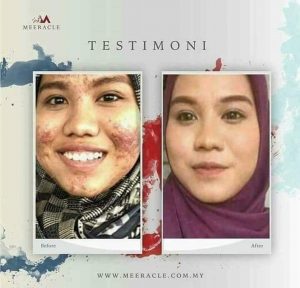 INFO MEERACLE GEMSTONE SKINCARE &#038; TESTIMONI, KOSMETIK CIDA