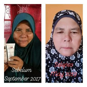 INFO MEERACLE GEMSTONE SKINCARE &#038; TESTIMONI, KOSMETIK CIDA