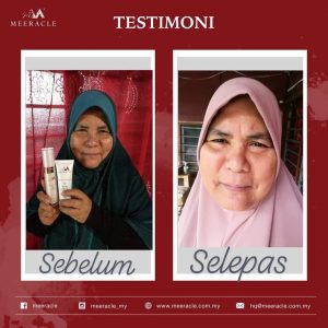 INFO MEERACLE GEMSTONE SKINCARE &#038; TESTIMONI, KOSMETIK CIDA