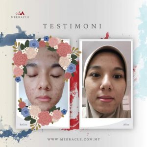 INFO MEERACLE GEMSTONE SKINCARE &#038; TESTIMONI, KOSMETIK CIDA