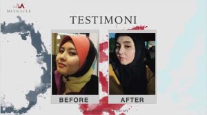 INFO MEERACLE GEMSTONE SKINCARE &#038; TESTIMONI, KOSMETIK CIDA