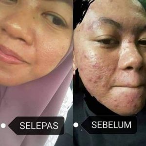 INFO MEERACLE GEMSTONE SKINCARE &#038; TESTIMONI, KOSMETIK CIDA