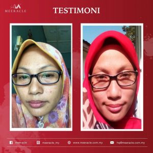 INFO MEERACLE GEMSTONE SKINCARE &#038; TESTIMONI, KOSMETIK CIDA