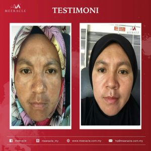 INFO MEERACLE GEMSTONE SKINCARE &#038; TESTIMONI, KOSMETIK CIDA