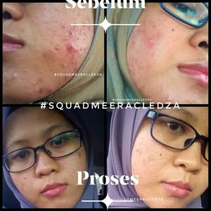 INFO MEERACLE GEMSTONE SKINCARE &#038; TESTIMONI, KOSMETIK CIDA