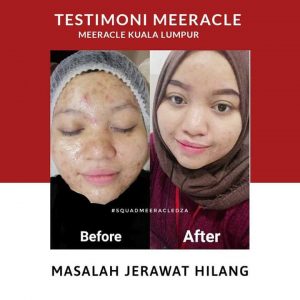 INFO MEERACLE GEMSTONE SKINCARE &#038; TESTIMONI, KOSMETIK CIDA