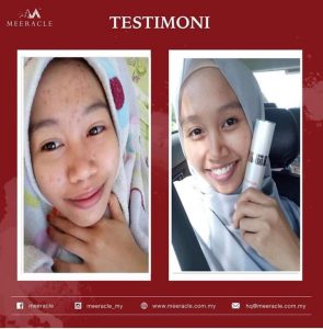 INFO MEERACLE GEMSTONE SKINCARE &#038; TESTIMONI, KOSMETIK CIDA