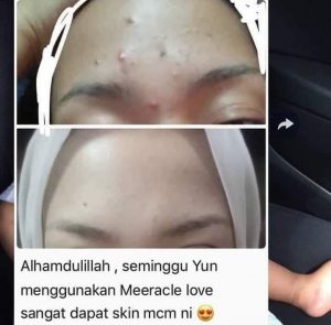 INFO MEERACLE GEMSTONE SKINCARE &#038; TESTIMONI, KOSMETIK CIDA