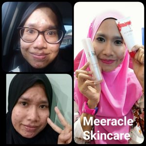 INFO MEERACLE GEMSTONE SKINCARE &#038; TESTIMONI, KOSMETIK CIDA