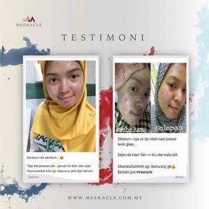 INFO MEERACLE GEMSTONE SKINCARE &#038; TESTIMONI, KOSMETIK CIDA