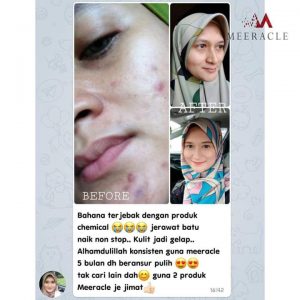 INFO MEERACLE GEMSTONE SKINCARE &#038; TESTIMONI, KOSMETIK CIDA