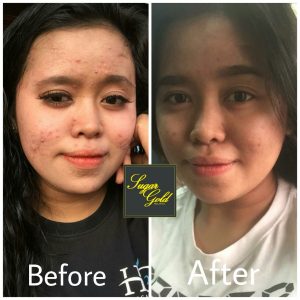 CARA PENGGUNAAN SUGAR GOLD OIL, KOSMETIK CIDA