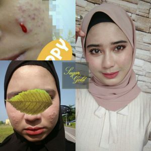 CARA PENGGUNAAN SUGAR GOLD OIL, KOSMETIK CIDA