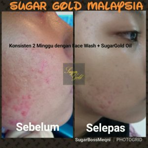 CARA PENGGUNAAN SUGAR GOLD OIL, KOSMETIK CIDA