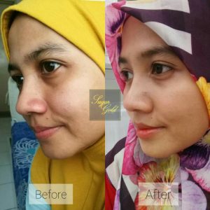 CARA PENGGUNAAN SUGAR GOLD OIL, KOSMETIK CIDA