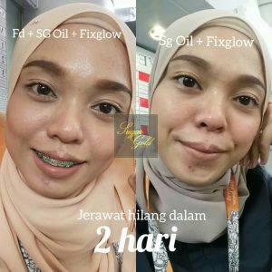 CARA PENGGUNAAN SUGAR GOLD OIL, KOSMETIK CIDA