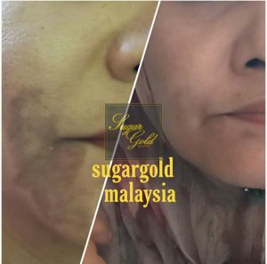 CARA PENGGUNAAN SUGAR GOLD OIL, KOSMETIK CIDA