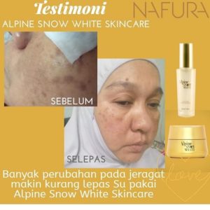 NAFURA MOISTURISER YANG MANA SESUAI DENGAN KULIT ANDA?, KOSMETIK CIDA