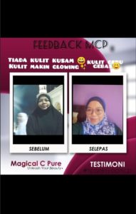 KEBAIKAN &#038; FEEDBACK MAGICAL C PURE -MANFAAT Vitamin C SEBENAR, KOSMETIK CIDA