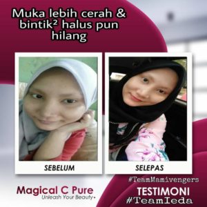 KEBAIKAN &#038; FEEDBACK MAGICAL C PURE -MANFAAT Vitamin C SEBENAR, KOSMETIK CIDA