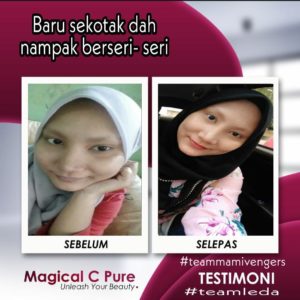 KEBAIKAN &#038; FEEDBACK MAGICAL C PURE -MANFAAT Vitamin C SEBENAR, KOSMETIK CIDA