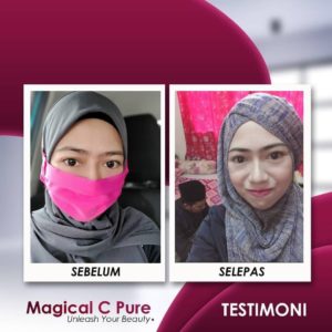 KEBAIKAN &#038; FEEDBACK MAGICAL C PURE -MANFAAT Vitamin C SEBENAR, KOSMETIK CIDA