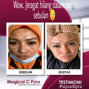 KEBAIKAN &#038; FEEDBACK MAGICAL C PURE -MANFAAT Vitamin C SEBENAR, KOSMETIK CIDA