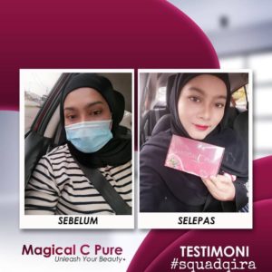 KEBAIKAN &#038; FEEDBACK MAGICAL C PURE -MANFAAT Vitamin C SEBENAR, KOSMETIK CIDA