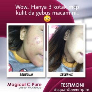 KEBAIKAN &#038; FEEDBACK MAGICAL C PURE -MANFAAT Vitamin C SEBENAR, KOSMETIK CIDA