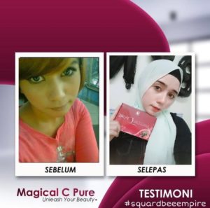 KEBAIKAN &#038; FEEDBACK MAGICAL C PURE -MANFAAT Vitamin C SEBENAR, KOSMETIK CIDA